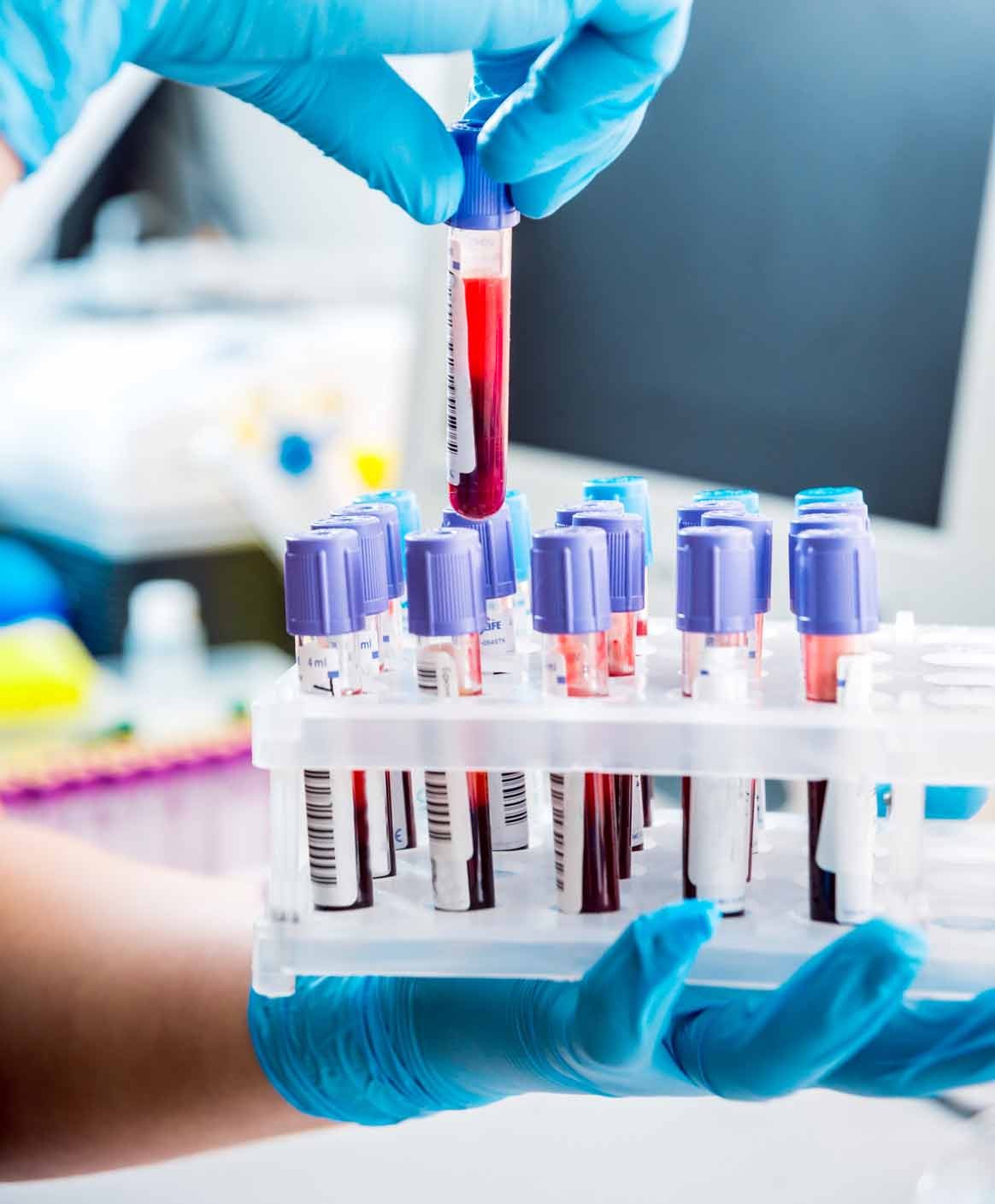 Gloved hands holding blood sample tubes in a laboratory rack